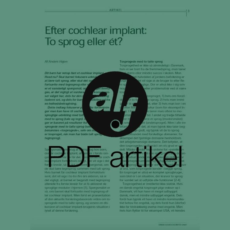 Efter cochlear implant - To sprog eller ét?